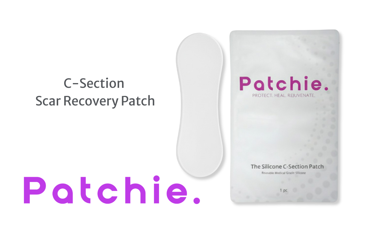 C-Section Scar Patches: The Best Way to Support Healing After a Caesarean