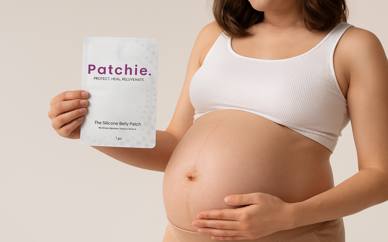 Why Silicone Patches Are a Game-Changer for Belly Stretch Marks in Pregnancy