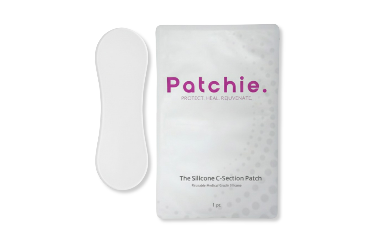 Scar Talk: How Big is a C-Section Scar and How Do I Treat It?