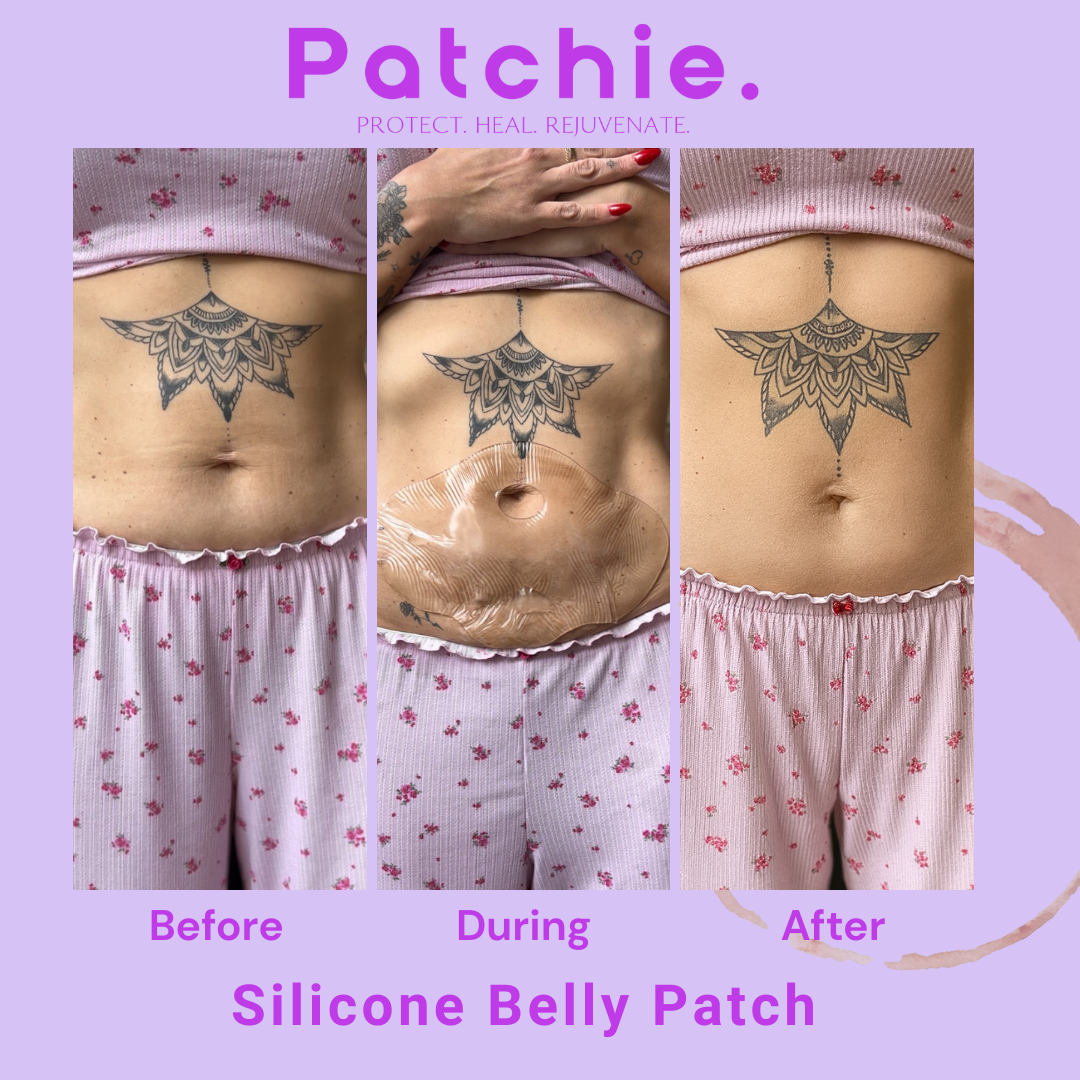 Silicone Belly Patch - Reusable 22 Times